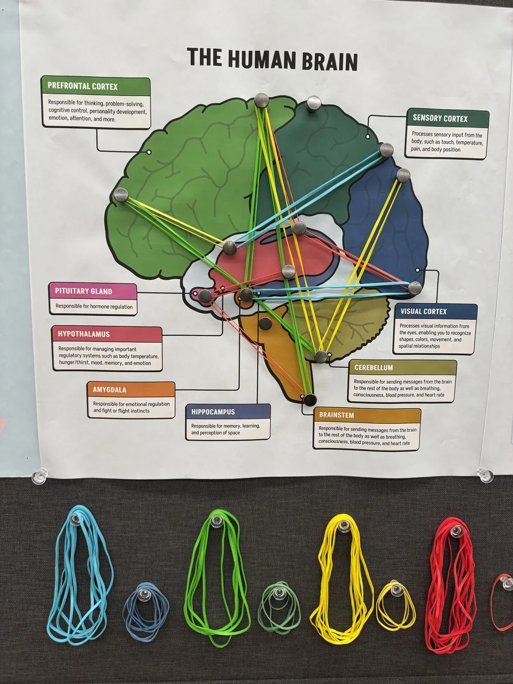 The brain panel in use. A colour-coded brain diagram with nine labelled regions, pins in each, criss-crossed with blue, green, yellow and red rubber bands. Spare bands in the four colours hang on hooks below.