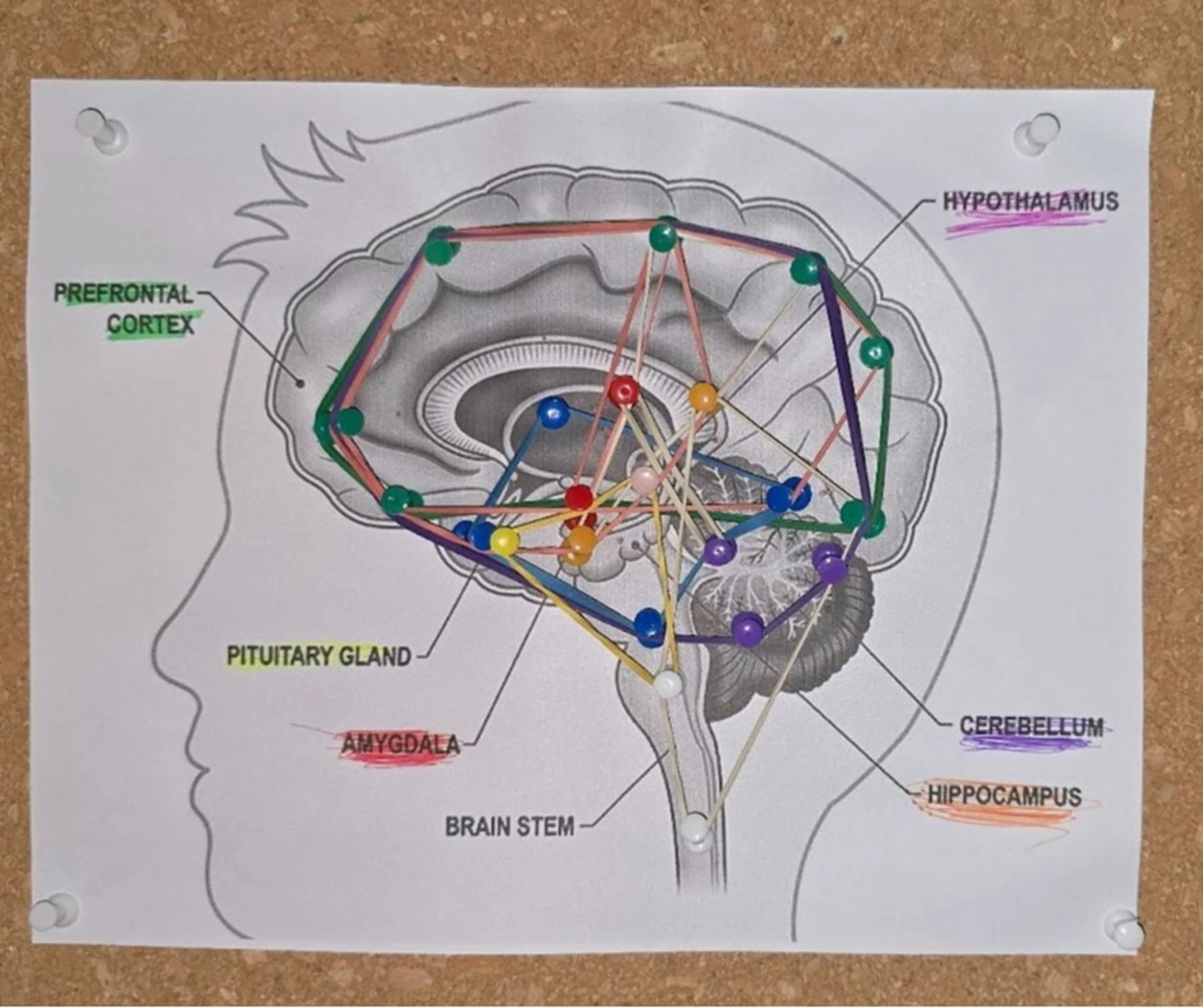 A printed brain diagram pinned to a cork board, seven regions named in capitals and highlighted in different colours, with coloured map pins in each region and rubber bands looped between them.